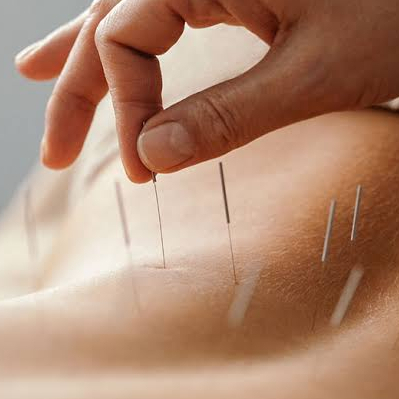 Grandmadisonacupuncture
